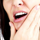 Illustration for article titled Guide to Wisdom Teeth Removal Austinem/em